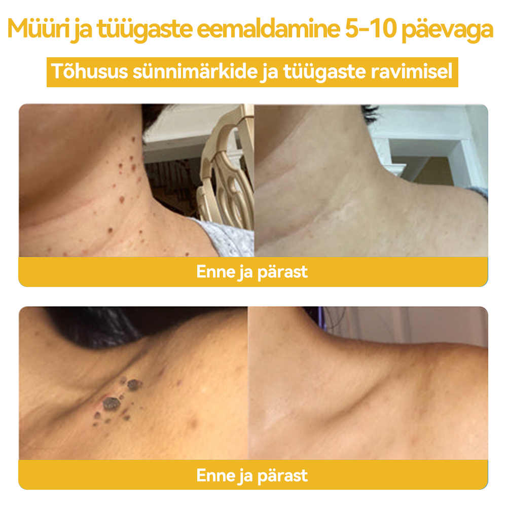 😊😊🌰𝐒𝐩𝐳𝐯™ 𝑴𝒆𝒔𝒊𝒍𝒂𝒔𝒕𝒆 𝒎ü𝒓𝒌𝑴üü𝒓𝒊- 𝒋𝒂 𝒕üü𝒈𝒂𝒔𝒕𝒆 𝒓𝒂𝒗𝒊𝒌𝒓𝒆𝒆𝒎(🔥𝑰𝒍𝒎𝒔𝒆𝒍𝒕 𝒍õ𝒑𝒆𝒃 𝒔𝒆𝒆)🐝🐝 (𝑽𝒊𝒊𝒎𝒂𝒔𝒆 𝒑ä𝒆𝒗𝒂 𝒔𝒐𝒐𝒅𝒖𝒔𝒑𝒂𝒌𝒌𝒖𝒎𝒊𝒏𝒆 80% 𝒎𝒂𝒉𝒂)🔥💥