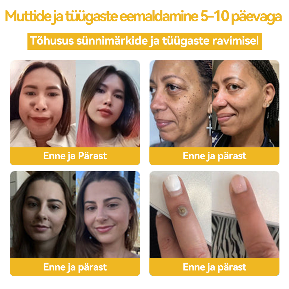 😊😊🌰𝐒𝐩𝐳𝐯™ 𝑴𝒆𝒔𝒊𝒍𝒂𝒔𝒕𝒆 𝒎ü𝒓𝒌𝑴üü𝒓𝒊- 𝒋𝒂 𝒕üü𝒈𝒂𝒔𝒕𝒆 𝒓𝒂𝒗𝒊𝒌𝒓𝒆𝒆𝒎(🔥𝑰𝒍𝒎𝒔𝒆𝒍𝒕 𝒍õ𝒑𝒆𝒃 𝒔𝒆𝒆)🐝🐝 (𝑽𝒊𝒊𝒎𝒂𝒔𝒆 𝒑ä𝒆𝒗𝒂 𝒔𝒐𝒐𝒅𝒖𝒔𝒑𝒂𝒌𝒌𝒖𝒎𝒊𝒏𝒆 80% 𝒎𝒂𝒉𝒂)🔥💥