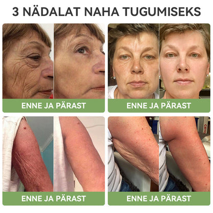 ✅Ametlik pood:𝐒𝐓𝐃𝐄𝐈™📦  𝐋𝐮𝐤𝐬𝐮𝐬𝐥𝐢𝐤 𝐤𝐨𝐥𝐥𝐚𝐠𝐞𝐞𝐧𝐢 𝐩𝐢𝐧𝐠𝐮𝐥𝐝𝐚𝐯 𝐤𝐫𝐞𝐞𝐦(🔥Piiratud aja 74% allahindlus!)