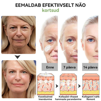 ✅Ametlik pood:𝐒𝐓𝐃𝐄𝐈™📦  𝐋𝐮𝐤𝐬𝐮𝐬𝐥𝐢𝐤 𝐤𝐨𝐥𝐥𝐚𝐠𝐞𝐞𝐧𝐢 𝐩𝐢𝐧𝐠𝐮𝐥𝐝𝐚𝐯 𝐤𝐫𝐞𝐞𝐦(🔥Piiratud aja 74% allahindlus!)