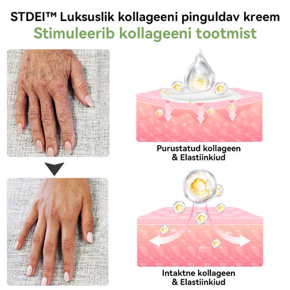 ✅Ametlik pood:𝐒𝐓𝐃𝐄𝐈™📦  𝐋𝐮𝐤𝐬𝐮𝐬𝐥𝐢𝐤 𝐤𝐨𝐥𝐥𝐚𝐠𝐞𝐞𝐧𝐢 𝐩𝐢𝐧𝐠𝐮𝐥𝐝𝐚𝐯 𝐤𝐫𝐞𝐞𝐦(🔥Piiratud aja 74% allahindlus!)