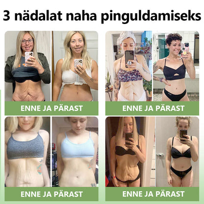 ✅Ametlik pood:𝐒𝐓𝐃𝐄𝐈™📦  𝐋𝐮𝐤𝐬𝐮𝐬𝐥𝐢𝐤 𝐤𝐨𝐥𝐥𝐚𝐠𝐞𝐞𝐧𝐢 𝐩𝐢𝐧𝐠𝐮𝐥𝐝𝐚𝐯 𝐤𝐫𝐞𝐞𝐦(🔥Piiratud aja 74% allahindlus!)