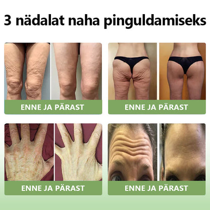 ✅Ametlik pood:𝐒𝐓𝐃𝐄𝐈™📦  𝐋𝐮𝐤𝐬𝐮𝐬𝐥𝐢𝐤 𝐤𝐨𝐥𝐥𝐚𝐠𝐞𝐞𝐧𝐢 𝐩𝐢𝐧𝐠𝐮𝐥𝐝𝐚𝐯 𝐤𝐫𝐞𝐞𝐦(🔥Piiratud aja 74% allahindlus!)