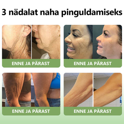 ✅Ametlik pood:𝐒𝐓𝐃𝐄𝐈™📦  𝐋𝐮𝐤𝐬𝐮𝐬𝐥𝐢𝐤 𝐤𝐨𝐥𝐥𝐚𝐠𝐞𝐞𝐧𝐢 𝐩𝐢𝐧𝐠𝐮𝐥𝐝𝐚𝐯 𝐤𝐫𝐞𝐞𝐦(🔥Piiratud aja 74% allahindlus!)
